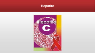 Hepatite 
 