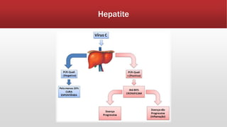 Hepatite 
 