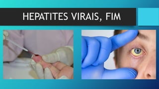 HEPATITES VIRAIS, FIM
 