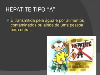HEPATITE TIPO “A” É transmitida pela água e por alimentos contaminados ou ainda de uma pessoa para outra . 