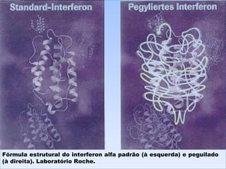 Fórmula estrutural do interferon alfa padrão (à esquerda) e peguilado (à direita). Laboratório Roche. 
