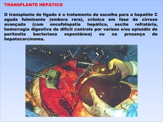 TRANSPLANTE HEPÁTICO   O transplante de fígado é o tratamento de escolha para a hepatite C aguda fulminante (embora rara), crônica em fase de cirrose avançada (com encefalopatia hepática, ascite refratária, hemorragia digestiva de difícil controle por varizes e/ou episódio de peritonite bacteriana espontânea) ou na presença de hepatocarcinoma.  