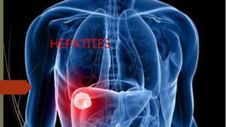 HEPATITES
 