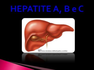 HEPATITE A, B e C 