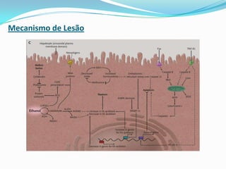 Mecanismo de Lesão
 