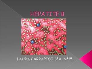 HEPATITE B LAURA CARRAPIÇO 6ºA, Nº15 