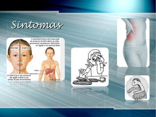 SintomasSintomas
 