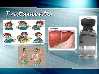 TratamentoTratamento
 