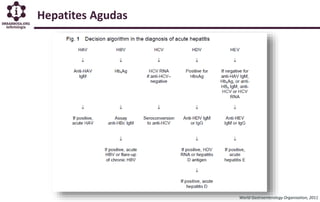 Hepatites Agudas
World Gastroenterology Organisation, 2011
 