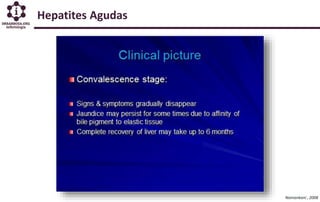 Hepatites Agudas
Namankani , 2008
 