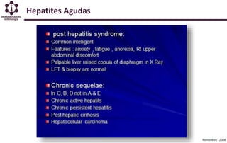 Hepatites Agudas
Namankani , 2008
 