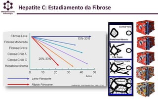 Hepatite C: Estadiamento da Fibrose
 