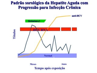 Padrão sorológico da Hepatite Aguda com
Progressão para Infecção Crônica
Sintomas+/-	
Tempo após exposição
Títulos anti-HCV
ALT	
Normal
0	 1	 2	 3	 4	 5	 6	 1	 2	 3	 4	
AnosMeses
HCV RNA
 