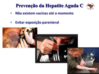 Prevenção da Hepatite Aguda C
•  Não	existem	vacinas	até	o	momento	
•  Evitar	exposição	parenteral	
 