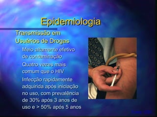 EpidemiologiaEpidemiologia
Transmissão emTransmissão em
Usuários de DrogasUsuários de Drogas
– Meio altamente efetivoMeio altamente efetivo
de contaminaçãode contaminação
– Quatro vezes maisQuatro vezes mais
comum que o HIVcomum que o HIV
– InfecInfecçãção rapidamenteo rapidamente
adquirida após iniciaçãoadquirida após iniciação
no uso, com prevalênciano uso, com prevalência
de 30% após 3 anos dede 30% após 3 anos de
uso e > 50% após 5 anosuso e > 50% após 5 anos
Fonte: CDC
 