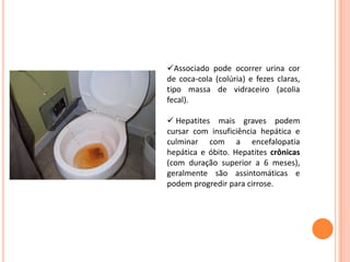 Associado pode ocorrer urina cor
de coca-cola (colúria) e fezes claras,
tipo massa de vidraceiro (acolia
fecal).
 Hepatites mais graves podem
cursar com insuficiência hepática e
culminar com a encefalopatia
hepática e óbito. Hepatites crônicas
(com duração superior a 6 meses),
geralmente são assintomáticas e
podem progredir para cirrose.
 