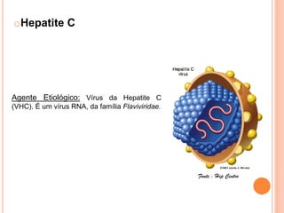 oHepatite C




Agente Etiológico: Vírus da Hepatite C
(VHC). É um vírus RNA, da família Flaviviridae.




                                                  Fonte : Hep Centro
 