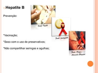 Hepatites b e c