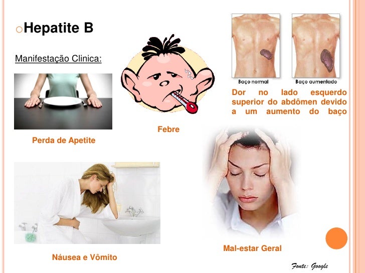 Exame hepatite b