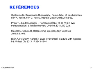 RÉFÉRENCES
20Claude EUGÈNE
Guillaume M, Bensenane-Oussalah M, Péron JM et al. Les hépatites
non-A, non-B, non-C, non-D. Hépato-Gastro 2018;25:52-69.
Phan TL, Lautenschlager I, Razonable RR et al. HHV-6 in liver
transplantation: a literature review Liver Int 2018;210-223.
Mueller D, Clauss H. Herpes virus infections Clin Liver Dis
2015;6:63-66.
Dinh A, Fleuret V, Hanslik T Liver involvement in adults with measles
Int J Infect Dis 2013;17:1243-1244. 
 