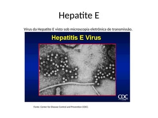 Hepatite E
Vírus da Hepatite E visto sob microscopia eletrônica de transmissão.
Fonte: Center for Disease Control and Prevention (CDC).
 