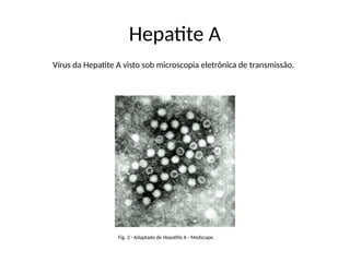 Hepatite A
Vírus da Hepatite A visto sob microscopia eletrônica de transmissão.
Fig. 2 - Adaptado de Hepatitis A - Medscape.
 