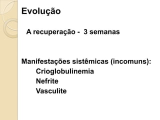 Evolução
A recuperação - 3 semanas
Manifestações sistêmicas (incomuns):
Crioglobulinemia
Nefrite
Vasculite
 