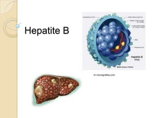 Hepatite B
br.monografias.com
 