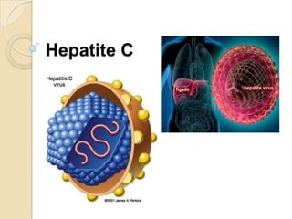 Hepatite C
 