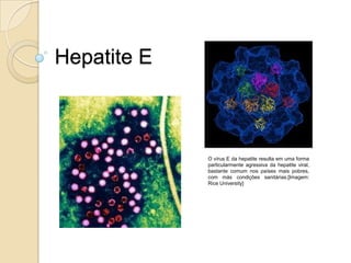 Hepatite E
O vírus E da hepatite resulta em uma forma
particularmente agressiva da hepatite viral,
bastante comum nos países mais pobres,
com más condições sanitárias.[Imagem:
Rice University]
 