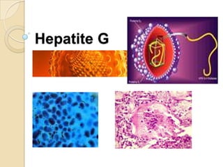 Hepatite G
 