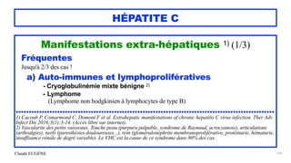 Claude EUGÈNE
HÉPATITE C
Manifestations extra-hépatiques 1) (1/3)


Fréquentes


Jusqu'à 2/3 des cas !


a) Auto-immunes et lymphoprolifératives


- Cryoglobulinémie mixte bénigne 2)


- Lymphome
 
(Lymphome non hodgkinien à lymphocytes de type B)


....................................................................................................


1) Cacoub P, Comarmond C, Domont F et al. Extrahepatic manifestations of chronic hepatitis C virus infection. Ther Adv
Infect Dis 2016;3(1):3-14. (Accès libre sur internet).


2) Vascularite des petits vaisseaux. Touche peau (purpura palpable, syndrome de Raynaud, acrocyanose), articulations
(arthralgies), nerfs (paresthésies douloureuses...), rein (glomérulonéphrite membranoproliférative, protéinurie, hématurie,
insuffisance rénale de degré variable). Le VHC est la cause de ce syndrome dans 80% des cas.


154
 