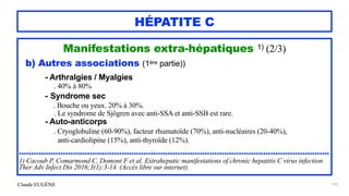 Claude EUGÈNE
HÉPATITE C
Manifestations extra-hépatiques 1) (2/3)


b) Autres associations (1ère partie))


- Arthralgies / Myalgies


. 40% à 80%


- Syndrome sec


. Bouche ou yeux. 20% à 30%.
 
. Le syndrome de Sjögren avec anti-SSA et anti-SSB est rare.


- Auto-anticorps
 
. Cryoglobuline (60-90%), facteur rhumatoïde (70%), anti-nucléaires (20-40%),
 
anti-cardiolipine (15%), anti-thyroïde (12%).


...............................................................................................................................


1) Cacoub P, Comarmond C, Domont F et al. Extrahepatic manifestations of chronic hepatitis C virus infection.
Ther Adv Infect Dis 2016;3(1):3-14. (Accès libre sur internet).


155
 