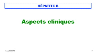 Claude EUGÈNE
HÉPATITE B
Aspects cliniques


28
 