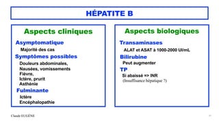 Claude EUGÈNE
HÉPATITE B
Aspects cliniques


Asymptomatique


Majorité des cas


Symptômes possibles


Douleurs abdominales,


Nausées, vomissements


Fièvre,


Ictère, prurit


Asthénie


Fulminante


Ictère


Encéphalopathie
31
Aspects biologiques


Transaminases


ALAT et ASAT à 1000-2000 UI/mL


Bilirubine


Peut augmenter


TP


Si abaissé => INR
 
(Insuffisance hépatique ?)
 