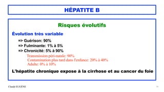 Claude EUGÈNE
HÉPATITE B
Risques évolutifs


Évolution très variable


=> Guérison: 90%


=> Fulminante: 1% à 5%


=> Chronicité: 5% à 90%


Transmission péri-natale: 90%
 
Contamination plus tard dans l'enfance: 20% à 40%
 
Adulte: 0% à 10%


L'hépatite chronique expose à la cirrhose et au cancer du foie


56
 