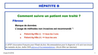 Claude EUGÈNE
HÉPATITE B
Comment suivre un patient non traité ?


Fibrose


Manque de données


L'usage de méthodes non invasives est recommandé 1)


• Patient Ag HBe (-) => tous les 3 ans


• Patient Ag HBe (+) => tous les ans


................................................................................................................................................................................................................................................


1) AFEF (Association Française pour l'Etude du foie). Recommandations pour le diagnostic et le suivi non-invasif
des maladies du foie. Juillet 2020 afef.asso.fr/recommandations. (Accès libre sur internet).


82
 