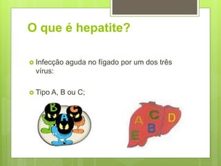 O que é hepatite?
 Infecção aguda no fígado por um dos três
vírus:
 Tipo A, B ou C;
 