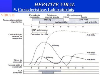 5. Características Laboratoriais
VÍRUS B
HEPATITE VIRAL
 