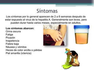 Síntomas
 Los síntomas por lo general aparecen de 2 a 6 semanas después de
estar expuesto al virus de la hepatitis A. Generalmente son leves, pero
     pueden durar hasta varios meses, especialmente en adultos.

Los síntomas abarcan:
Orina oscura
Fatiga
Picazón
Inapetencia
Fiebre baja
Náusea y vómitos
Heces de color arcilla o pálidas
Piel amarilla (ictericia)
 