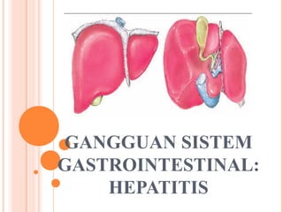 GANGGUAN SISTEM
GASTROINTESTINAL:
    HEPATITIS
 