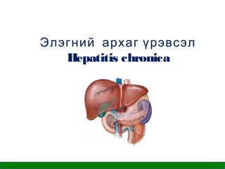 Элэгний архаг үрэвсэл
Hepatitis chronica

 