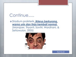 7

Continue.....
 Stadium

praikterik. Ikterus berkurang,
warna urin dan tinja kembali normal.
(Mansjoer, Triyanti, Savitri, Wardhani, &
Setiowulan, 2005)

Kembali

 