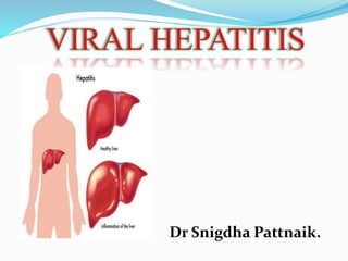 VIRAL HEPATITIS
Dr Snigdha Pattnaik.
 