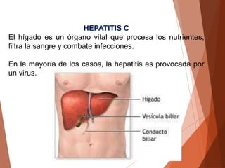 HEPATITIS C
El hígado es un órgano vital que procesa los nutrientes,
filtra la sangre y combate infecciones.
En la mayoría de los casos, la hepatitis es provocada por
un virus.
 