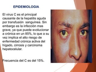 EPIDEMIOLOGIA
El virus C es el principal
causante de la hepatitis aguda
por transfusión sanguínea. Sin
embargo es la infección mas
grave, ya que puede evolucionar
a crónica en un 85%, lo que a su
vez implica el alto riesgo de
enfermedad crónica activa del
hígado, cirrosis y carcinoma
hepatocelular.
Frecuencia del C es del 15%.
 