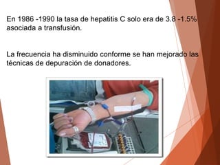 En 1986 -1990 la tasa de hepatitis C solo era de 3.8 -1.5%
asociada a transfusión.
La frecuencia ha disminuido conforme se han mejorado las
técnicas de depuración de donadores.
 