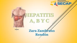 HEPATITIS
A, B Y C
Zara Zambrano
Rendón
 
