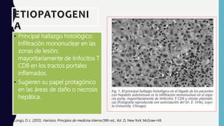 • Principal hallazgo histológico:
Infiltración mononuclear en las
zonas de lesión;
mayoritariamente de linfocitos T
CD8 en los tractos portales
inflamados.
• Sugieren su papel protagónico
en las áreas de daño o necrosis
hepática.
Longo, D. L. (2012). Harrison, Principios de medicina Interna (18th ed., Vol. 2). New York: McGraw-Hill.
 