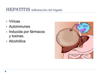 HEPATITIS Inflamación del hígado
 Víricas
 Autoinmunes
 Inducida por fármacos
y toxinas.
 Alcohólica
 